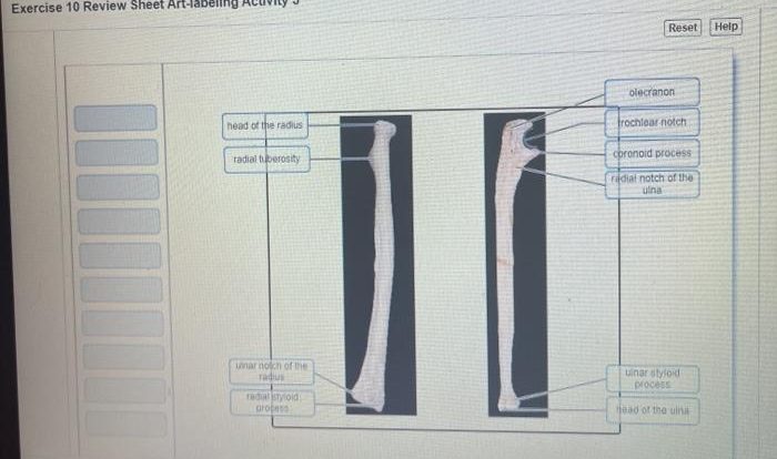 Exercise 10 review sheet art-labeling activity 6